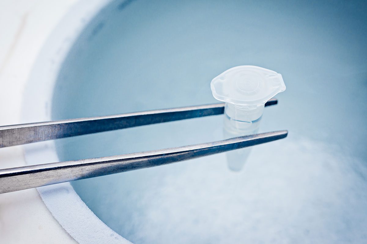 How much does egg freezing cost